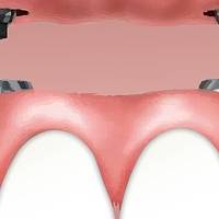 Вижте каталога ни с естетична стоматология 13 от MedicalDent Вижте каталога ни с естетична стоматология 13