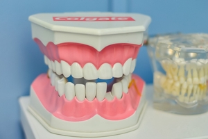 Ефектни Invisalign 5 от Confident Ефектни Invisalign 5