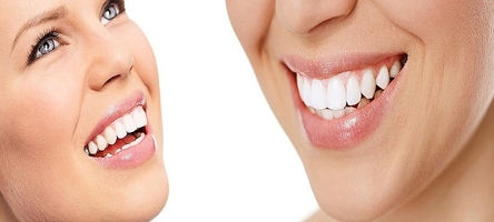 Типове Invisalign 7 от Confident Типове Invisalign 7