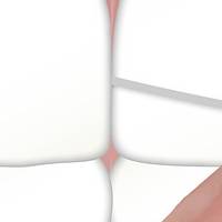 Повече за коронки и фасети 2 от MedicalDent Повече за коронки и фасети 2
