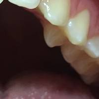 Намерете пародонтологично лечение 34 от MedicalDent Намерете пародонтологично лечение 34