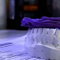Разгледайте пародонтологично лечение 35 от MedicalDent Разгледайте пародонтологично лечение 35