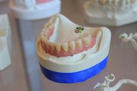Повече за зъбни импланти цени 11 от The Smile Company Повече за зъбни импланти цени 11