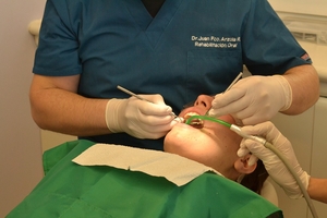 Learn more about Dental Implants 10