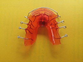 Offers for Dental Implants 14