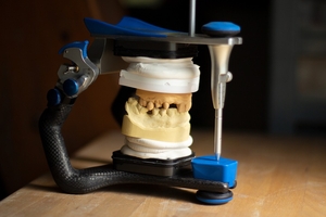 Info about Dental Implants 19