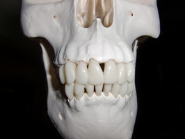Best Deals on Dental Implants 34