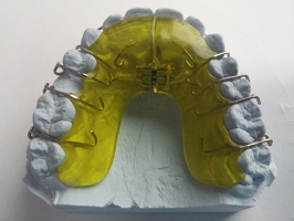 See more about Dental Implants 38