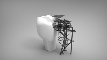 Select Dental Implants 9