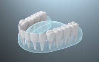 избелване на зъби цена - 22861 клиенти | Dentalcare избелване на зъби цена - 27934 клиенти