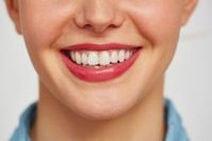 бондинг на зъби - 55659 клиенти | Supreme Dental бондинг на зъби - 51876 клиенти