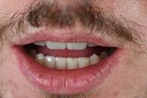 дентална клиника софия - 66012 клиенти