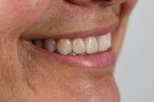 дентална клиника софия - 68699 постижения