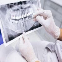 пломба на зъб цена - 80718 новини пломба на зъб цена - 80652 новини