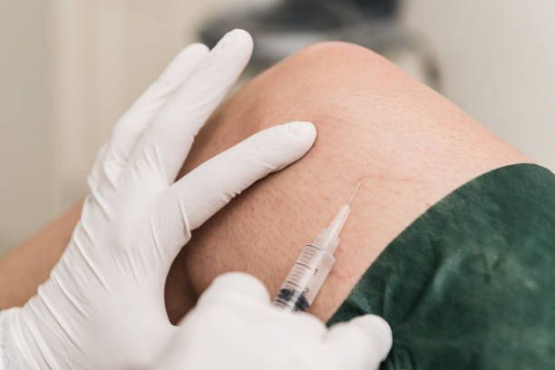 склеротерапия - 47528 бестселъри